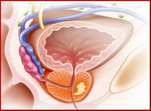 Prostasen precio farmacia similares